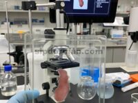 Resveratrol Meningkatkan Nefrektomi Unilateral/Cedera Oksidatif yang Diinduksi Amikasin pada Jaringan Ginjal Tikus