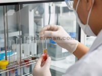 Bioavailabilitas dan modulasi mikrobiota usus polifenol dari cangkang Camellia oleifera selama pencernaan dan fermentasi in vitro
